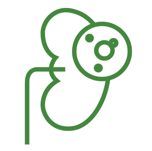 Prevence močových kamenů